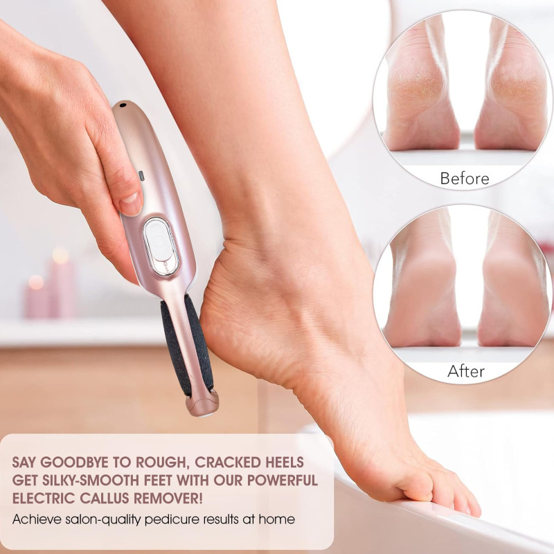 Electric pedicure Callus Remover